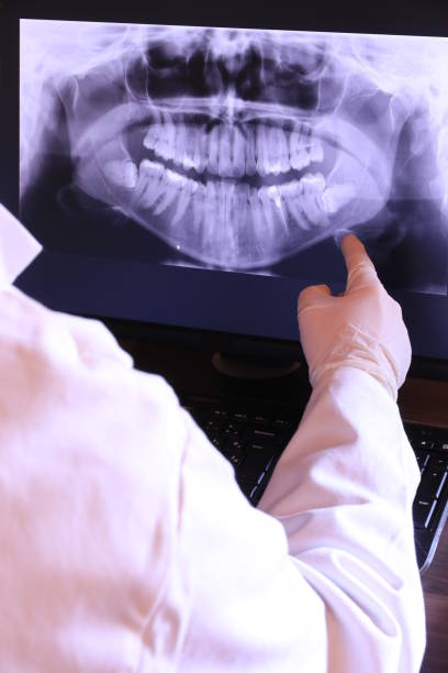 Best Emergency Treatment for Oral Infections in Highgrove, CA